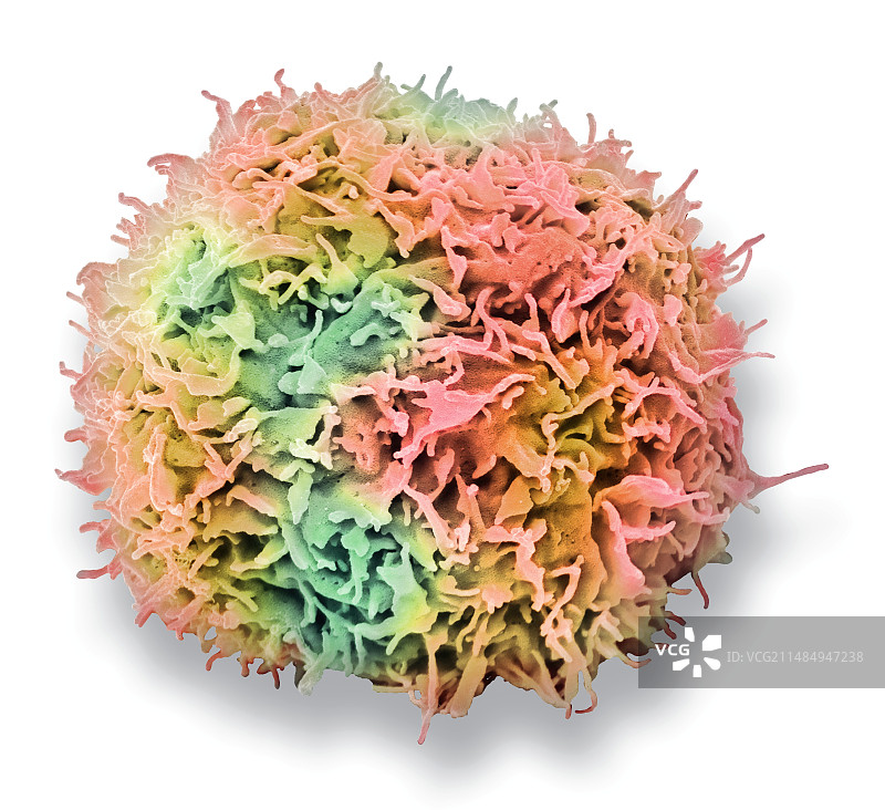 脑癌细胞扫描电镜图图片素材