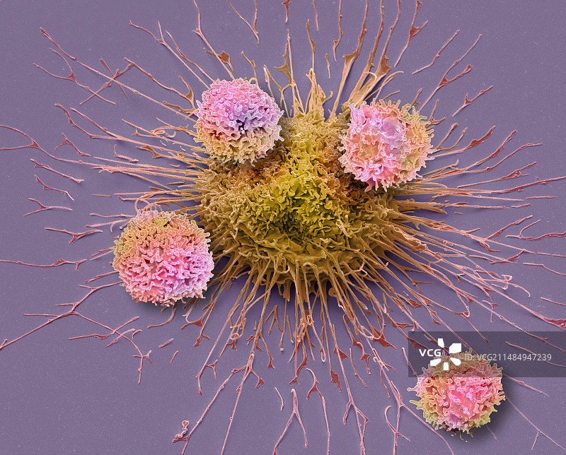 CAR T细胞疗法，扫描电镜图片素材