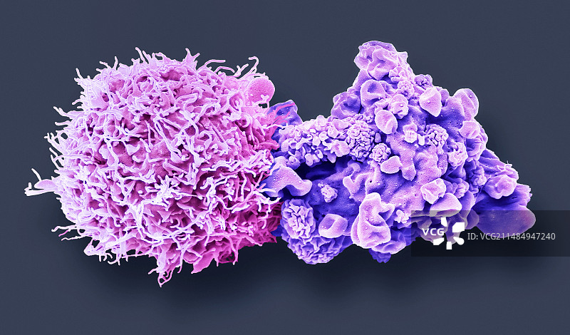 脑癌细胞扫描电镜图图片素材