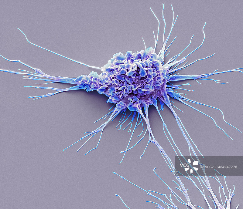 树突状细胞扫描电镜图图片素材