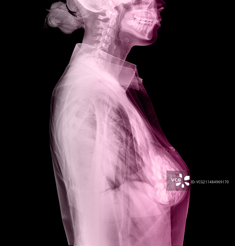 乳腺癌防治意识概念图图片素材