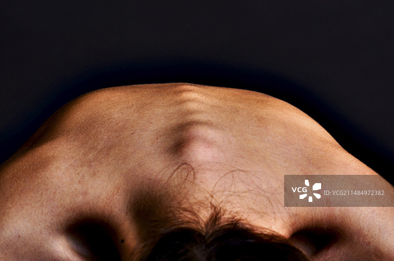 脊柱和脊椎骨图片素材