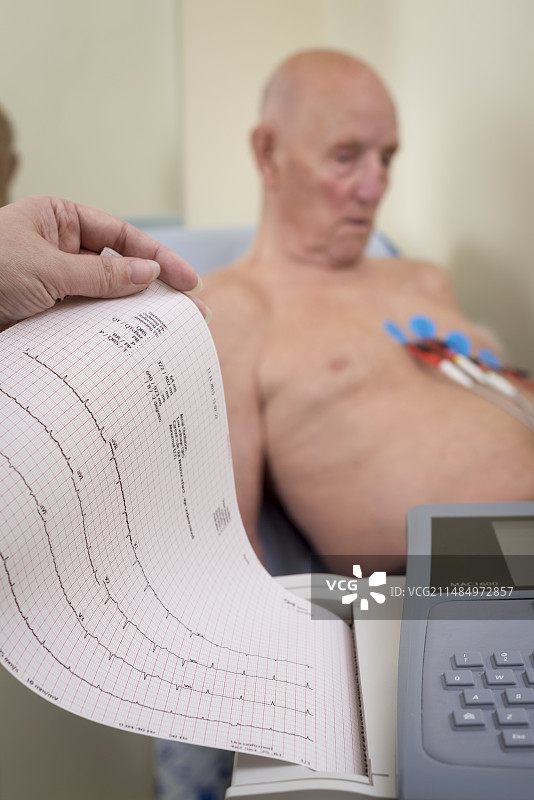 心电图检查图片素材