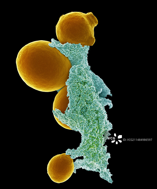 酵母与细胞外基质扫描电镜图图片素材