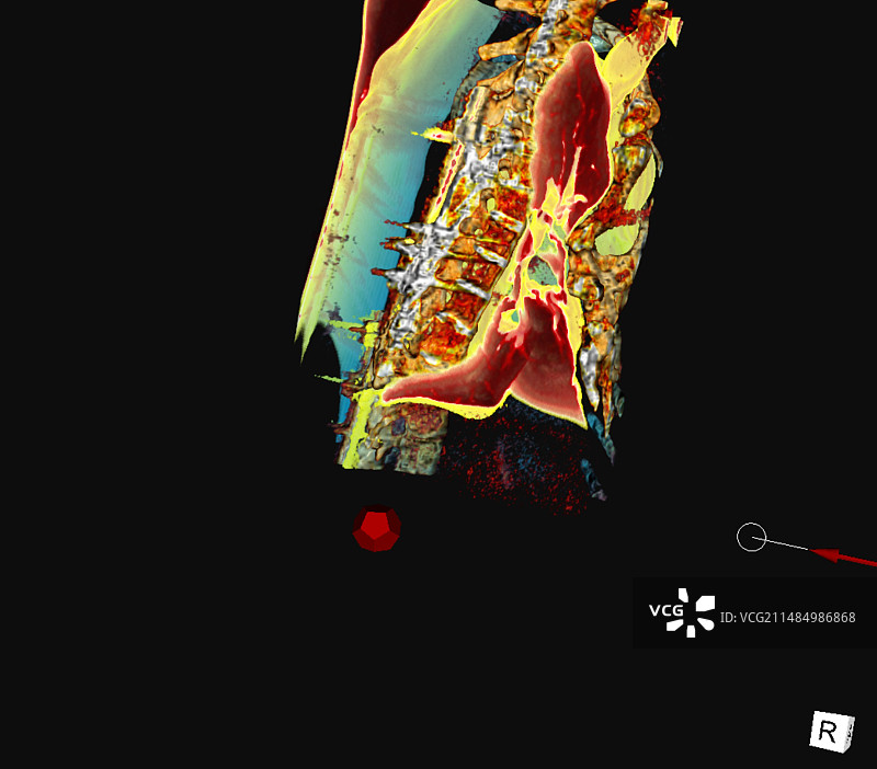 沉没的箱子，3D CT扫描图片素材