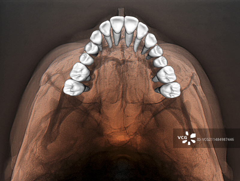 正常牙齿3D CBCT扫描图片素材