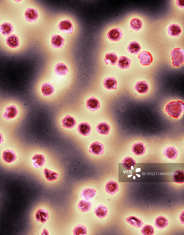 蛙病毒属病毒颗粒，TEM图片素材