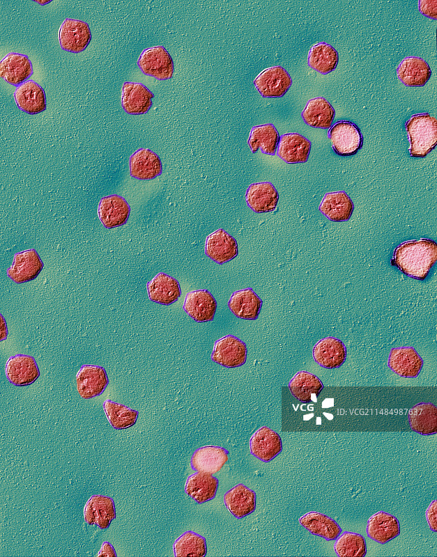 蛙病毒属病毒颗粒，TEM图片素材