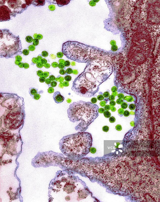 劳斯肉瘤病毒感染，TEM图片素材