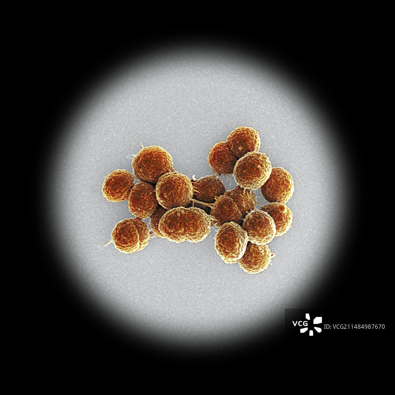 粪肠球菌细菌，扫描电镜图片素材