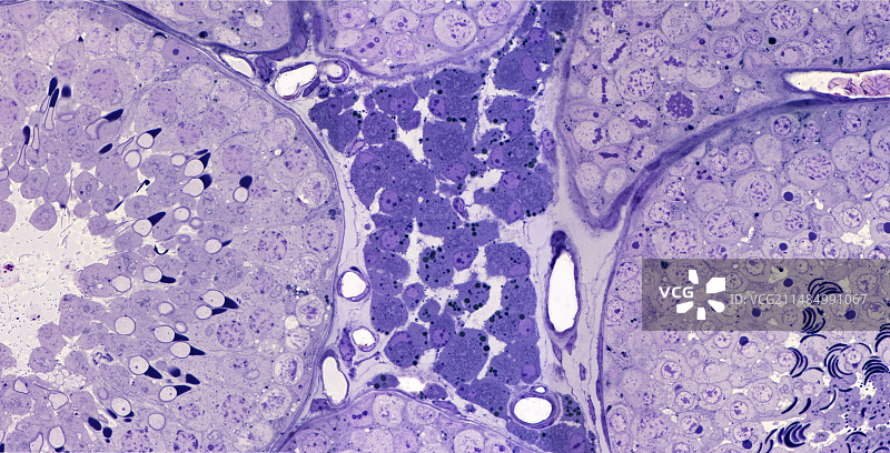 睾丸间质细胞显微照片图片素材
