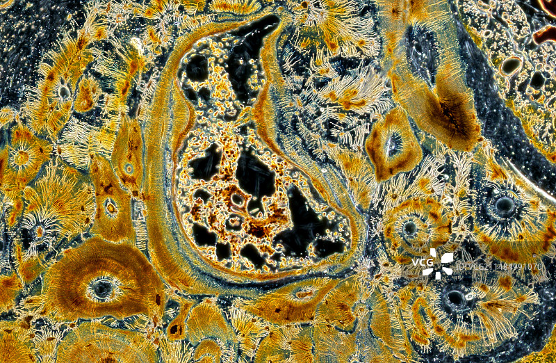 骨骼，光学显微照片图片素材