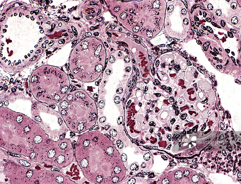 肾小体显微照片图片素材