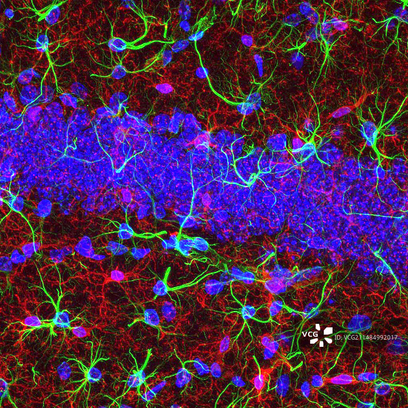 脑细胞荧光显微照片图片素材