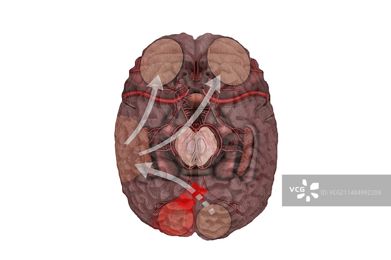 无失写症失读症插画图片素材