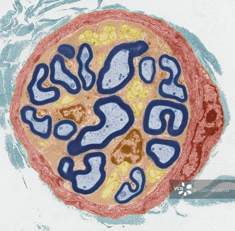 外周神经，TEM图片素材