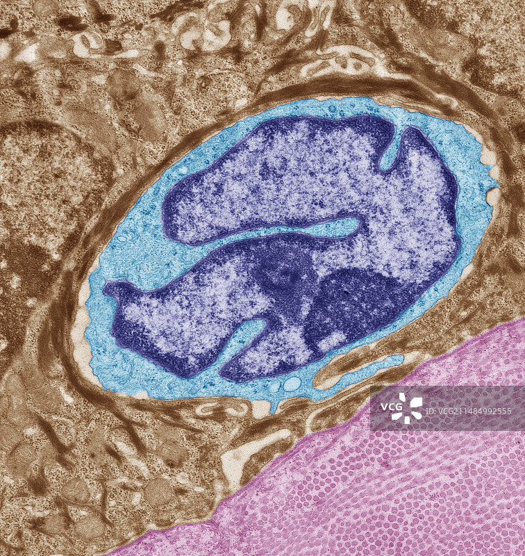 朗格汉斯细胞，透射电镜图片素材