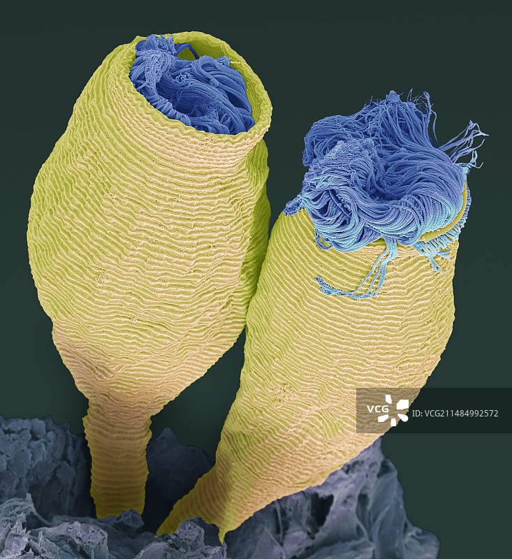 钟虫，扫描电镜图图片素材