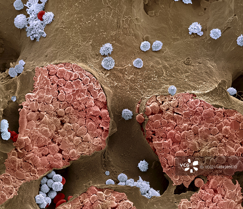 骨髓扫描电镜图图片素材