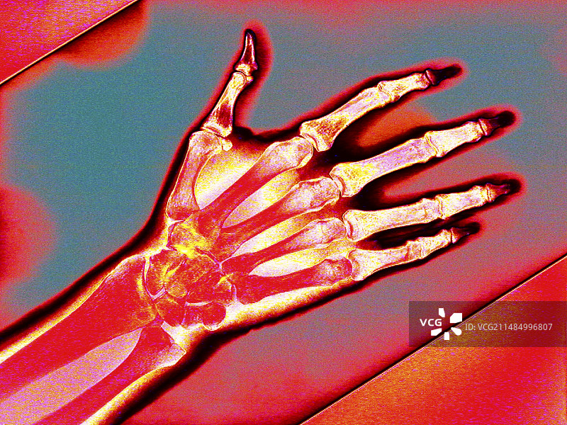 彩色X光手部图图片素材