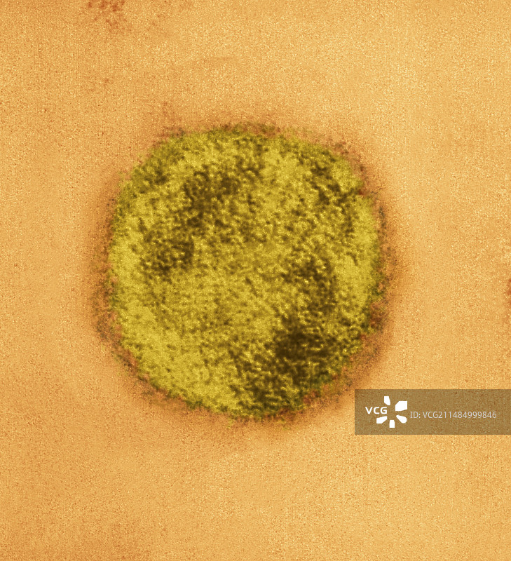 辛诺布雷病毒粒子,TEM图片素材