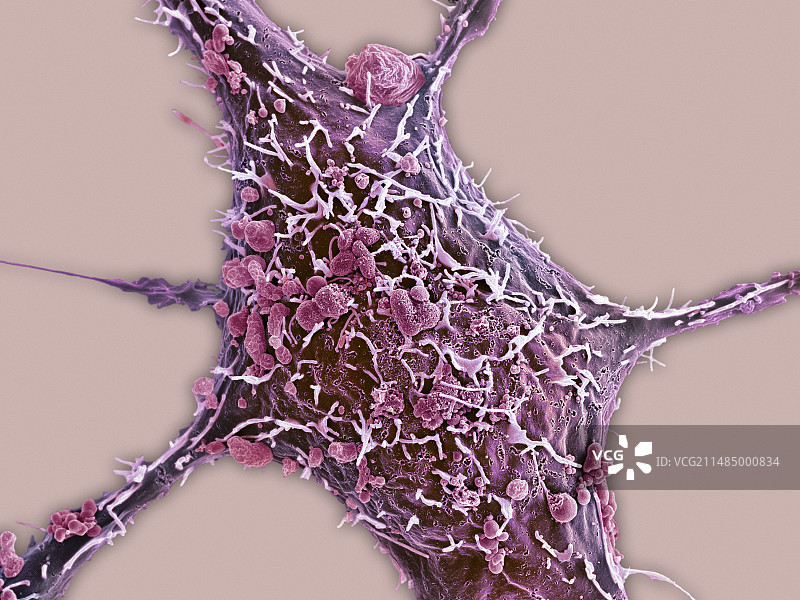 乳腺癌细胞扫描电镜图图片素材