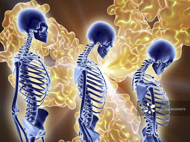 使用抗体治疗骨质疏松症图片素材