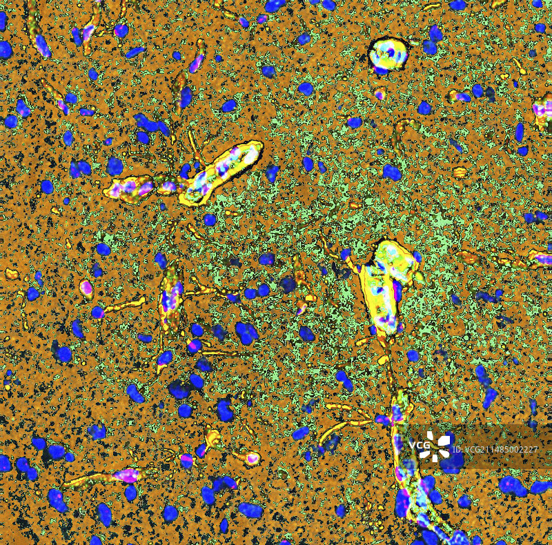 大脑血管显微照片图片素材