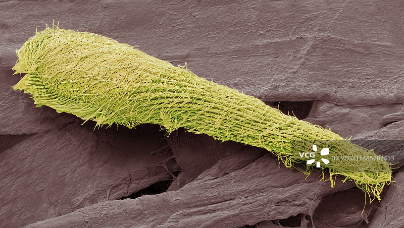 喇叭虫纤毛原生动物扫描电镜图片素材