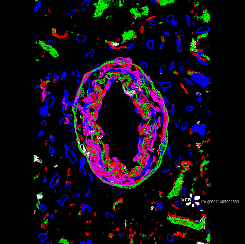 动脉壁图片素材
