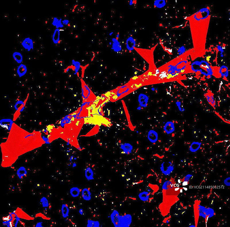 大脑中的内皮一氧化氮图片素材