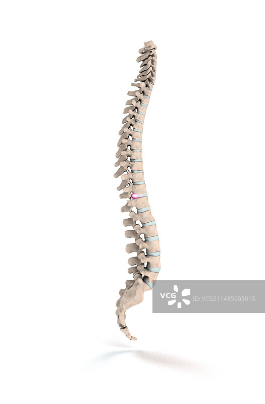 椎间盘突出插图图片素材