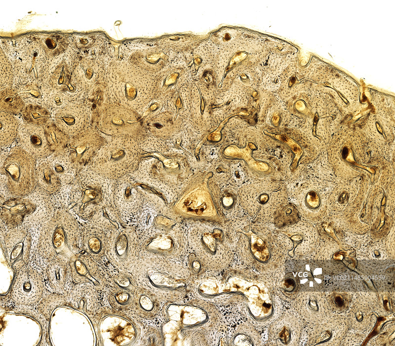 骨骼，光学显微照片图片素材