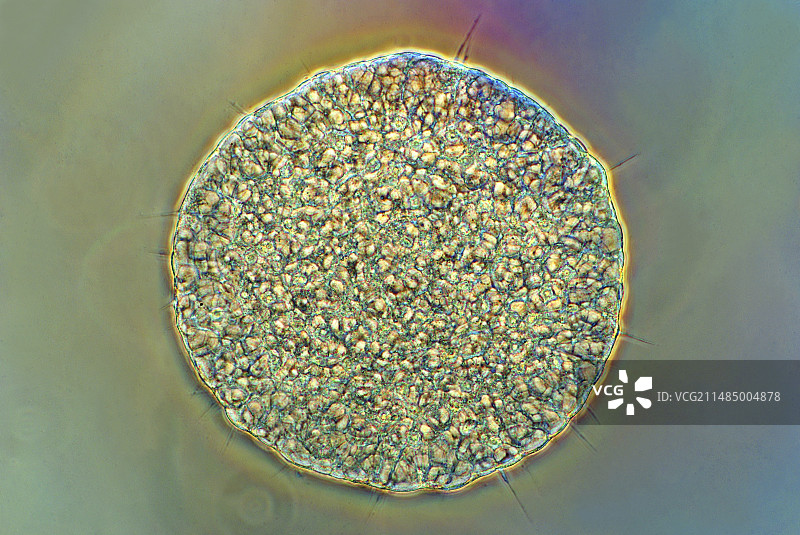太阳虫原生动物显微照片图片素材