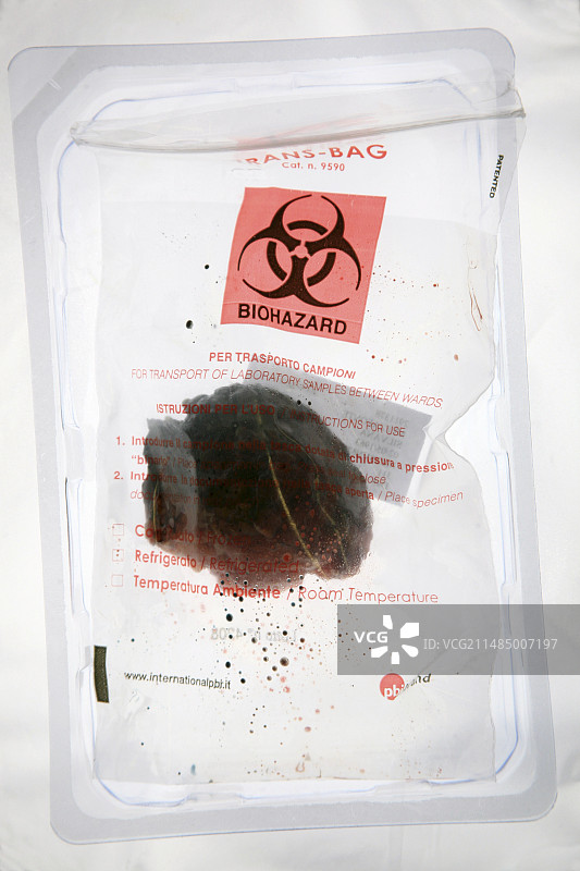 生物危害袋中的组织样本图片素材