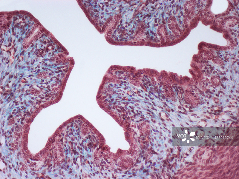 子宫壁显微照片图片素材