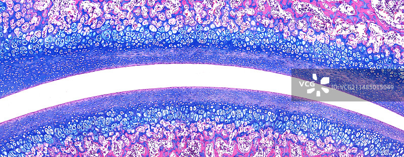 骨关节间隙显微照片图片素材