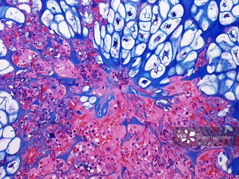 胎儿骨骼显微照片图片素材