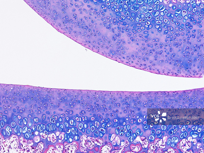 关节软骨显微照片图片素材