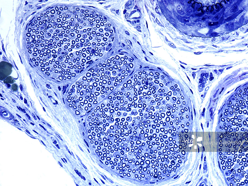 周围神经，光学显微照片图片素材
