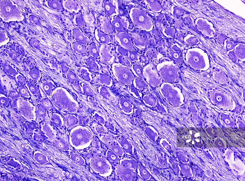 脊髓感觉神经节显微照片图片素材