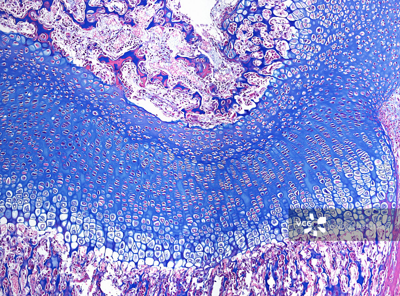 骨骺生长板的光学显微照片图片素材