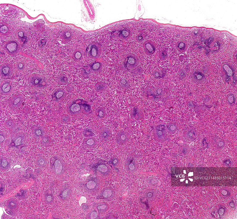 脾脏显微照片图片素材