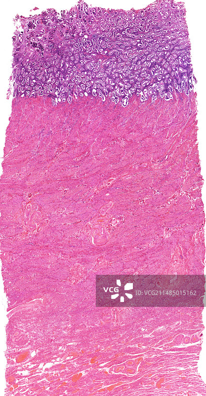 子宫显微照片图片素材