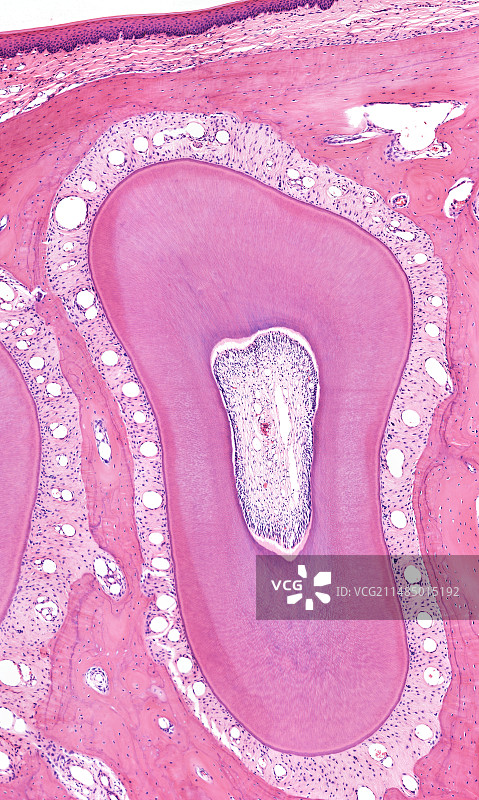 牙齿显微照片图片素材