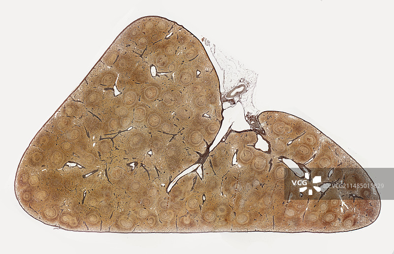 脾脏显微照片图片素材