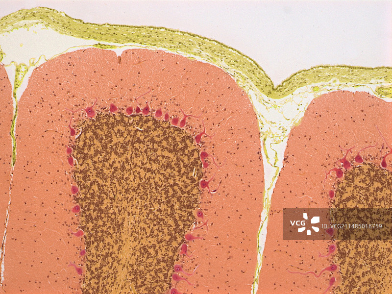 小脑显微照片图片素材