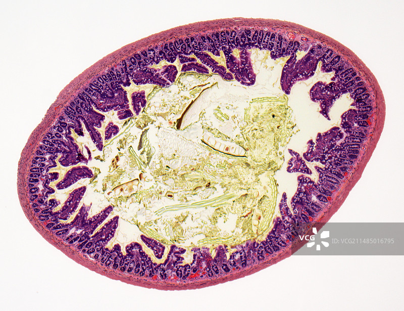小肠，光学显微照片图片素材