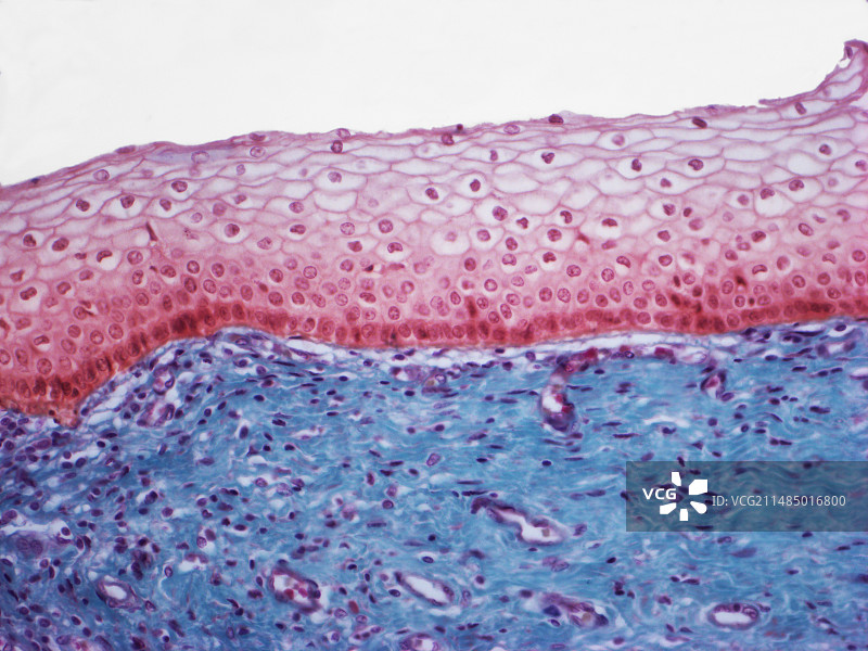 阴道组织光学显微照片图片素材