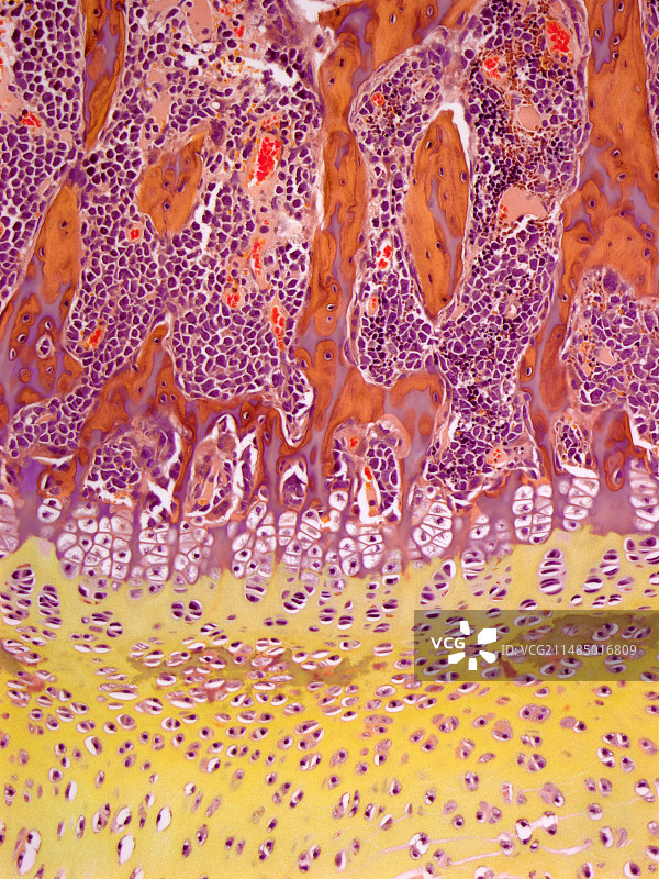 骨骼生长，光学显微照片图片素材